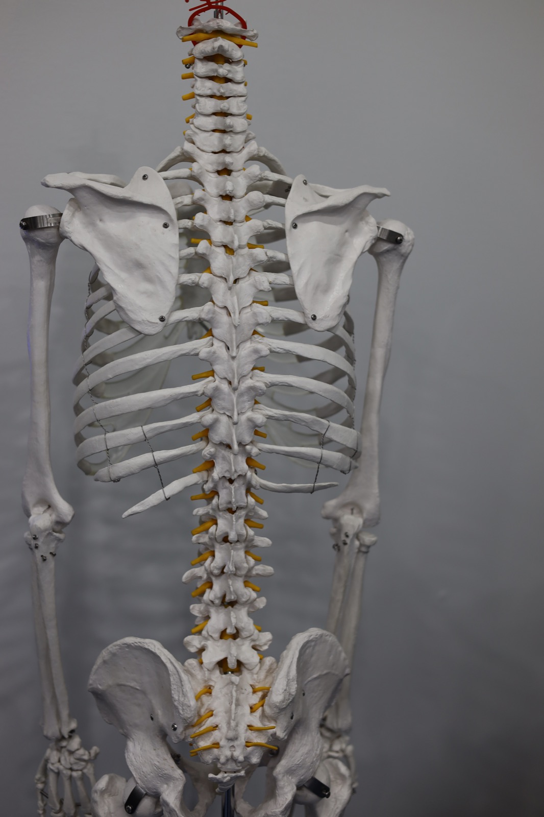 Spine model used to explain injuries