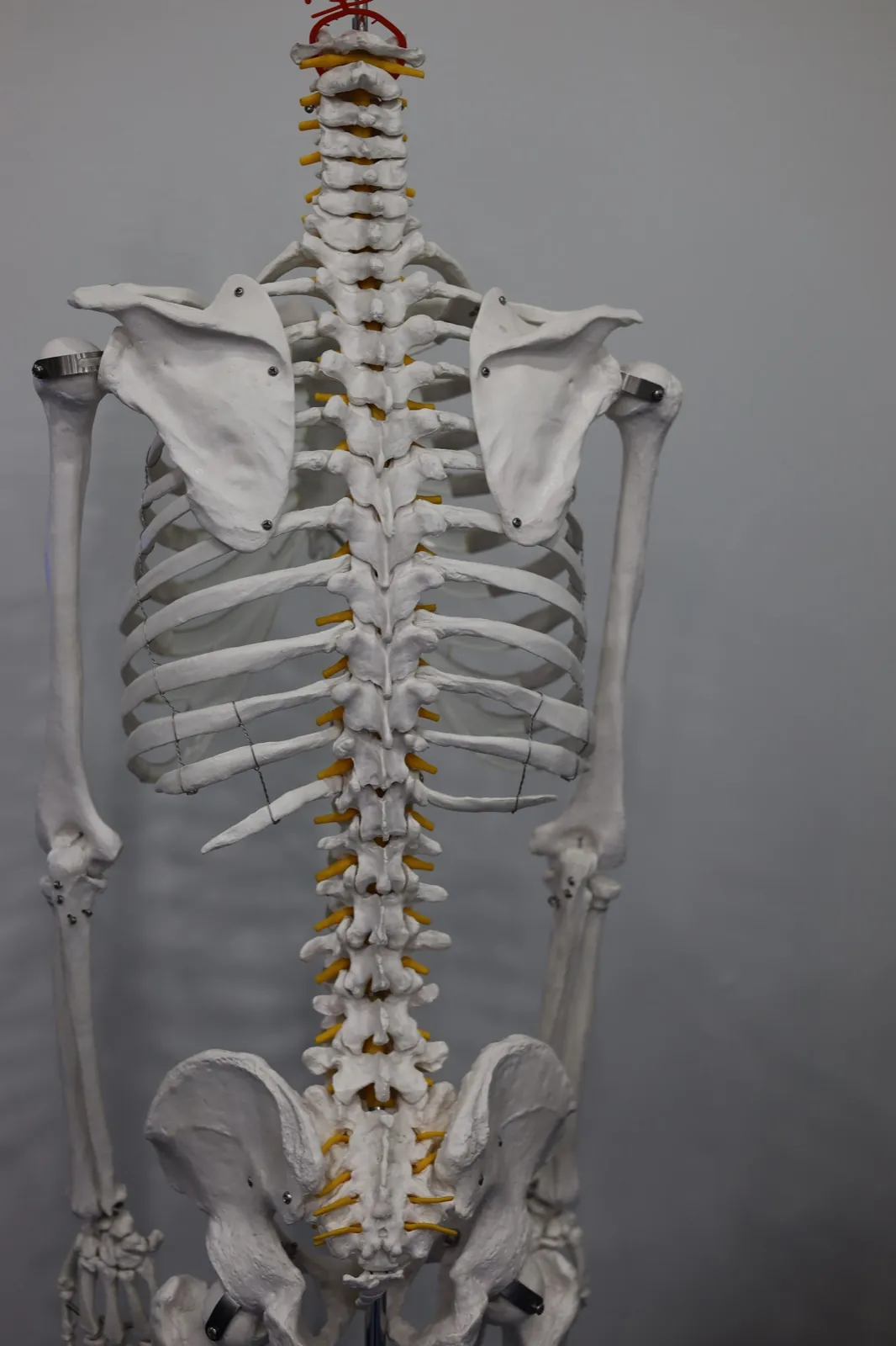 Spine model used to explain injuries