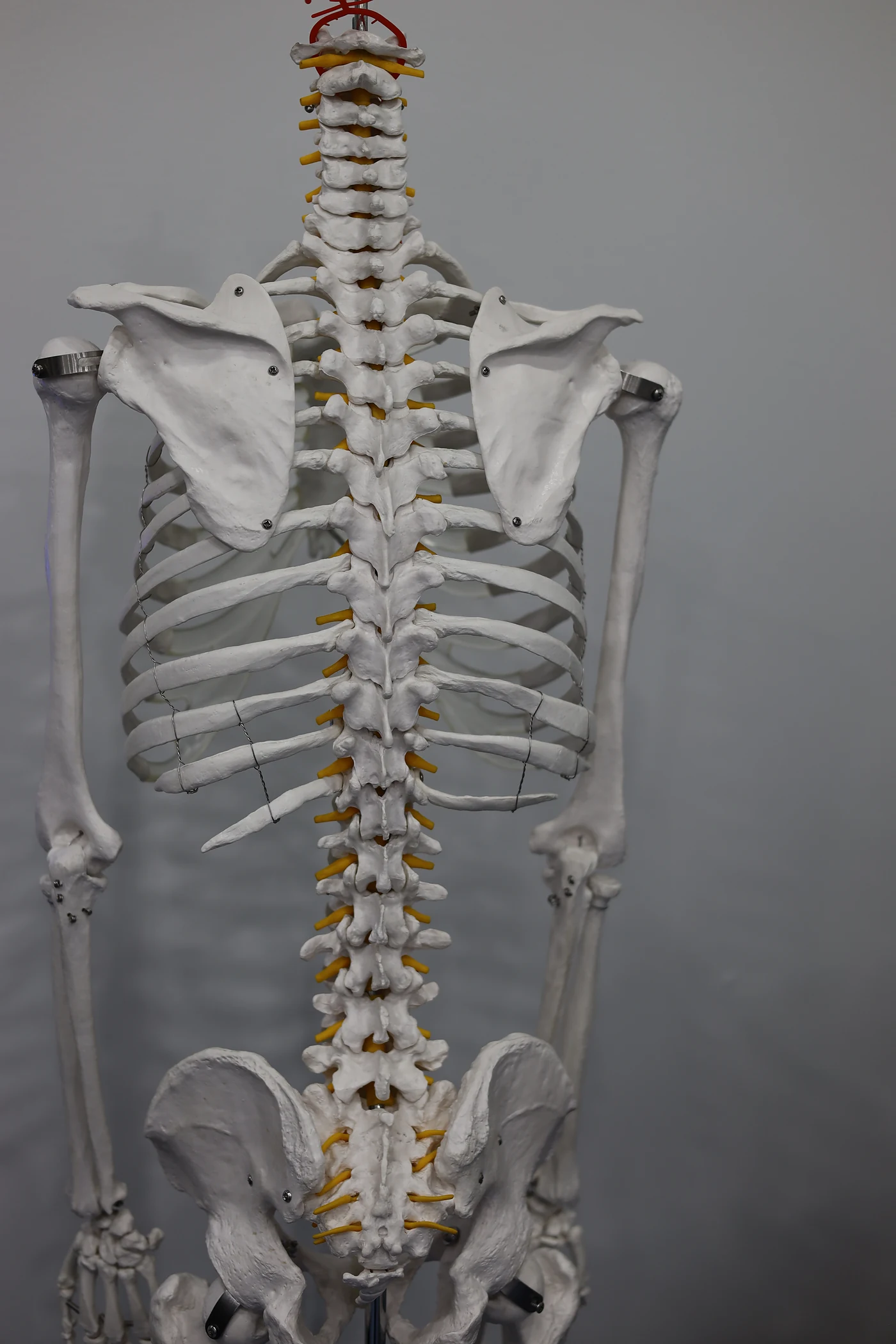 Spine model used to explain injuries