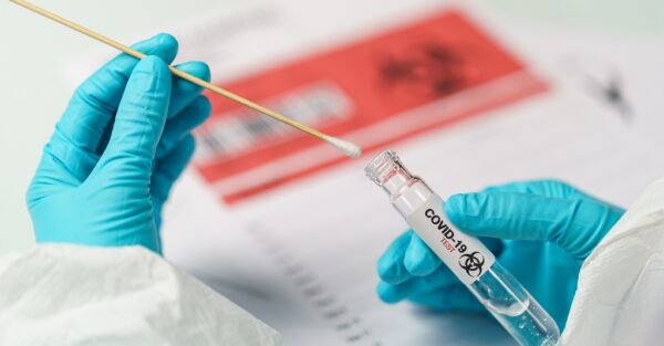 Positive Result On Test For COVID-19