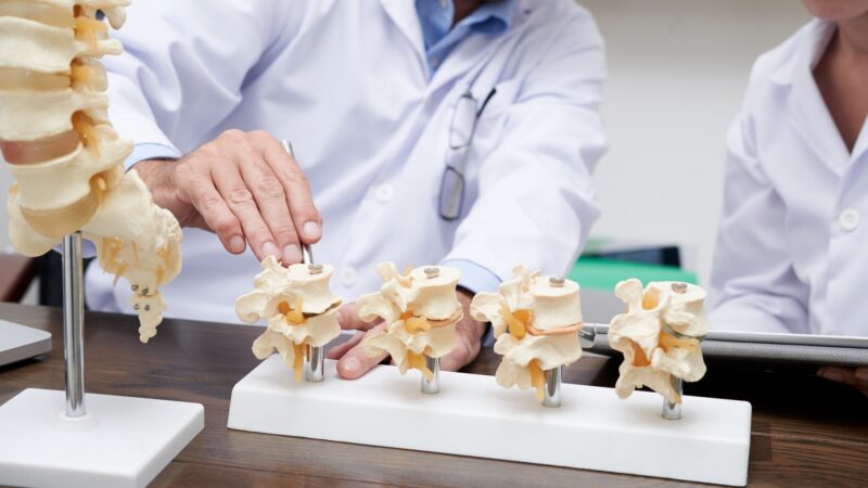 Doctor showing various spinal sections showing intervertebral disc space disease