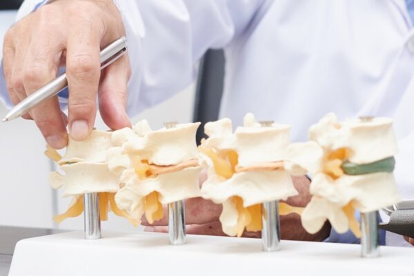 Doctor explaining various spine diseases by the example of plastic models