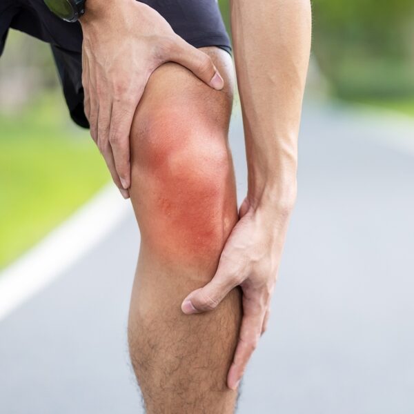 Young adult male with muscle pain during running. runner have knee ache due to Runners Knee or Patellofemoral Pain Syndrome, osteoarthritis and Patellar Tendinitis. Sports injuries and medical concept